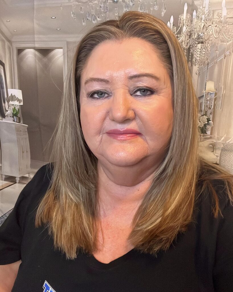 A woman over 60 with a sleek and straight warm-blonde lob that falls just past her shoulders.